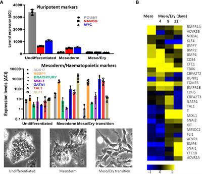 Novel stem cell technologies are powerful tools to understand the impact of human factors on Plasmodium falciparum malaria